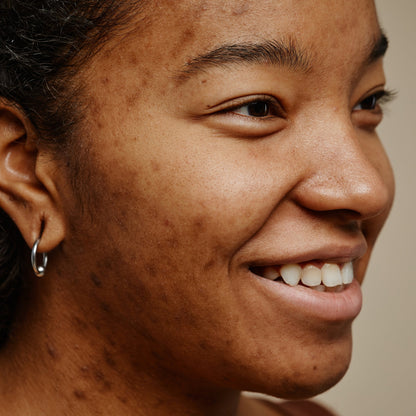 Close-up of smiling face showing skin texture and tone.
